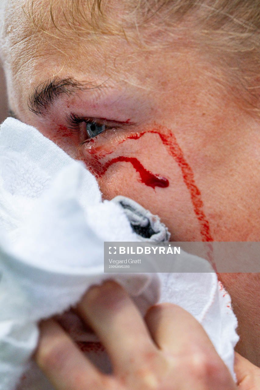 Sophie Román Haug of Norway in pain