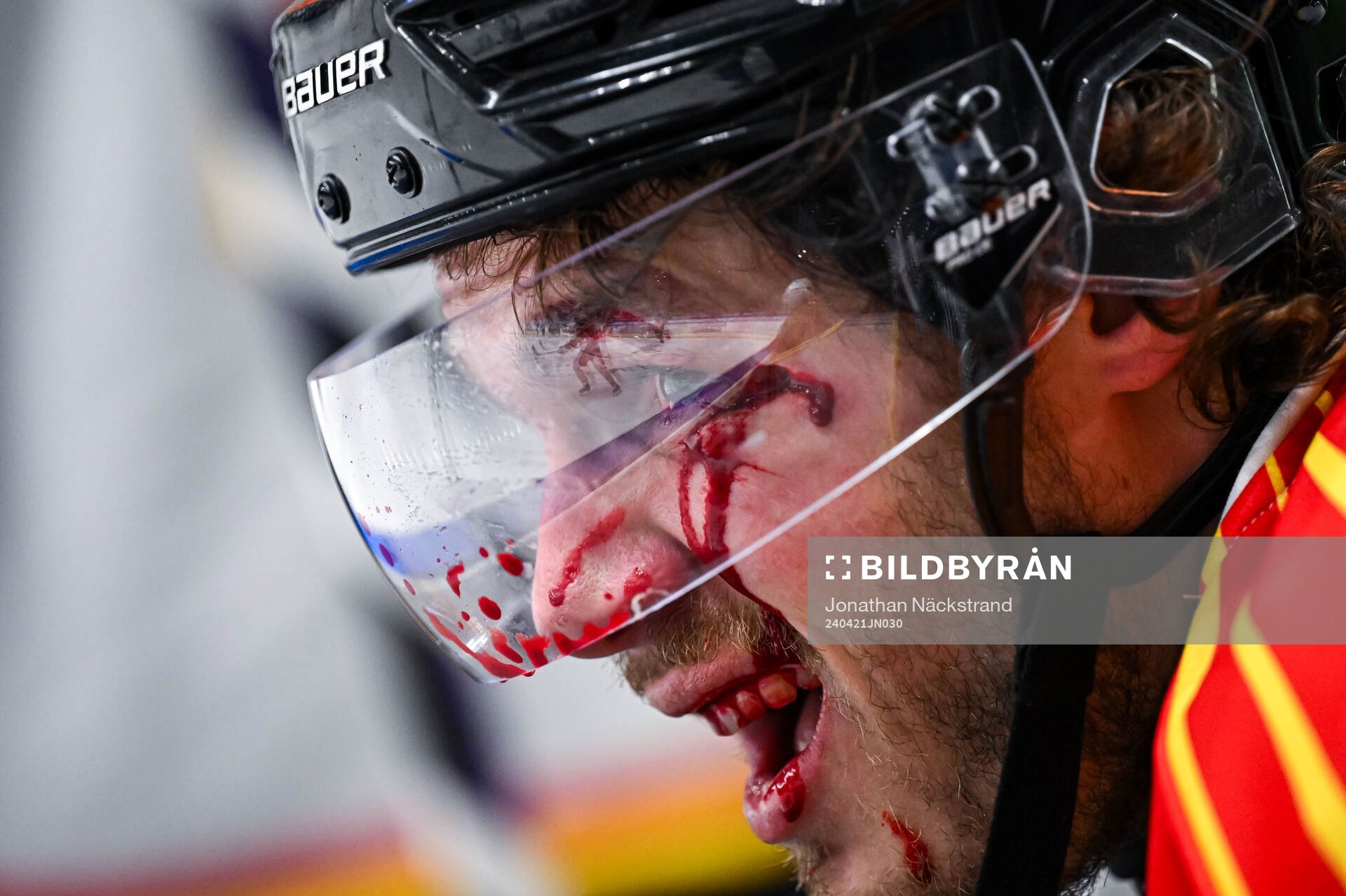 Brynäs Tyler Kelleher har ont