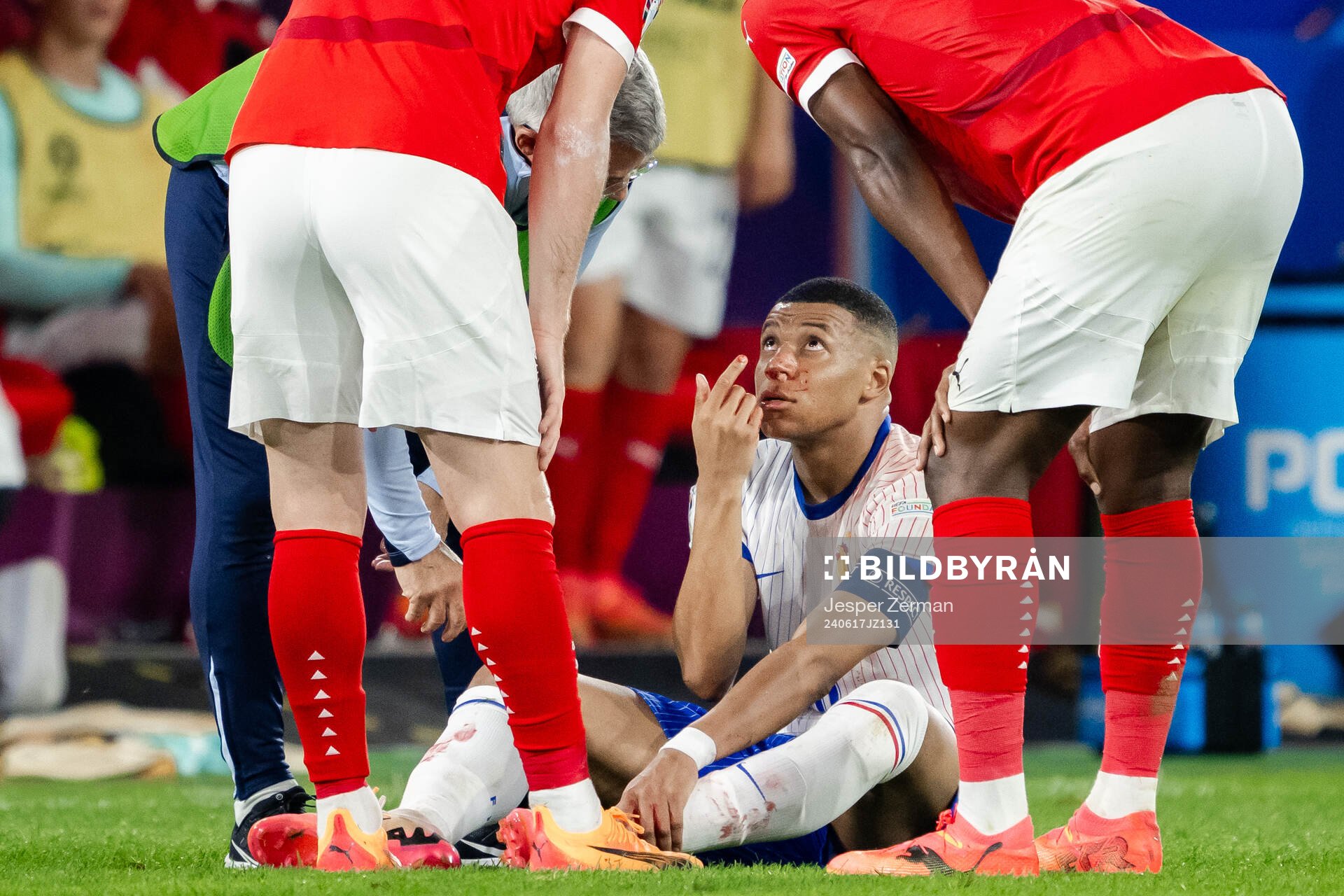 Kylian Mbappé of France in pain
