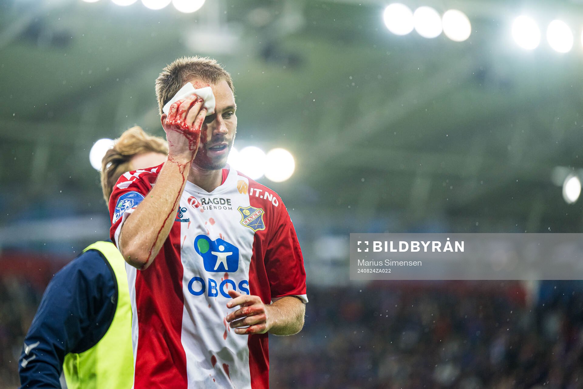 Julius Friberg Skaug of Lyn with an injury during the OBOS-ligaen match between Vålerenga and Lyn on August 24, 2024 in Oslo.