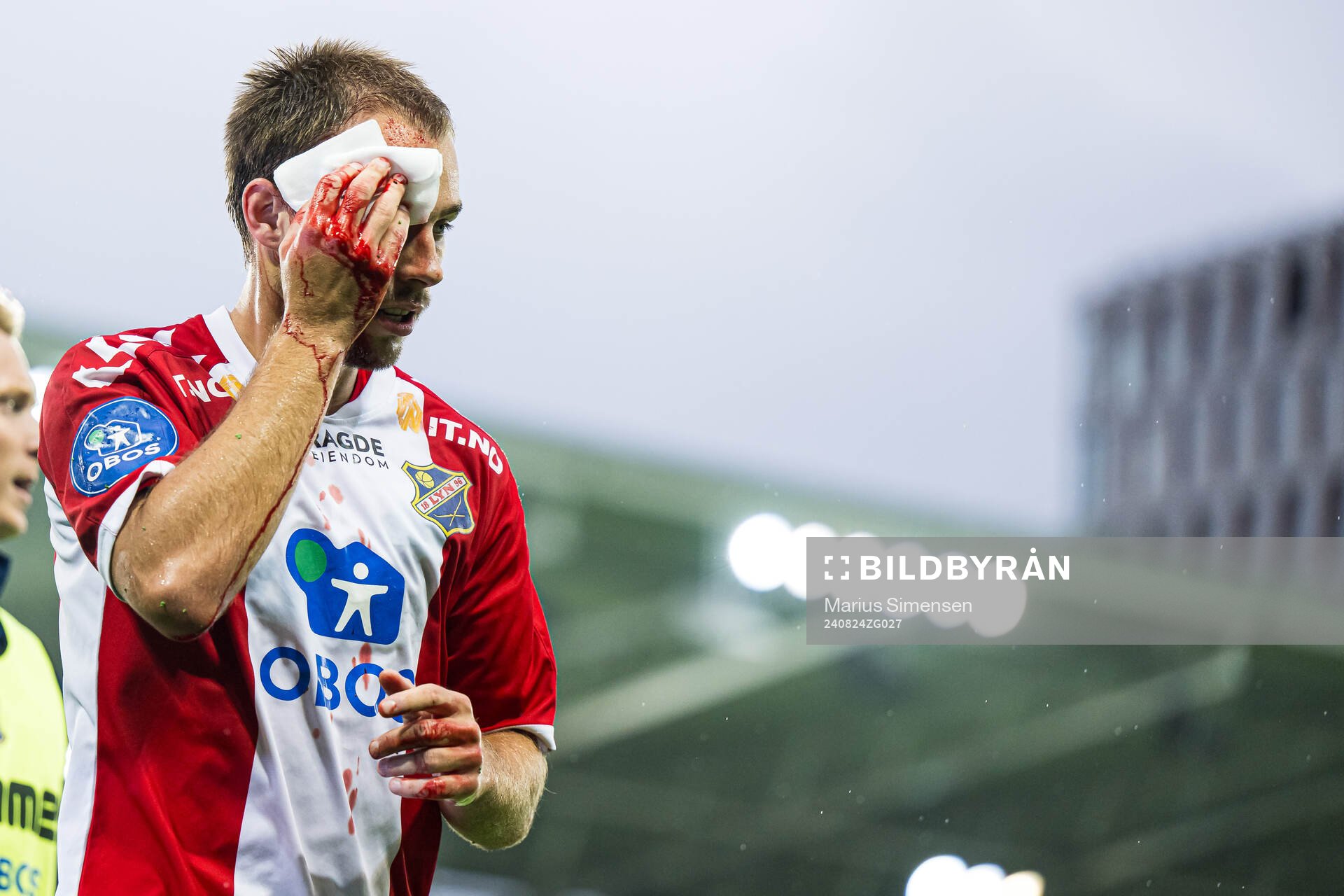 Julius Friberg Skaug of Lyn with an injury during the OBOS-ligaen match between Vålerenga and Lyn on August 24, 2024 in Oslo.