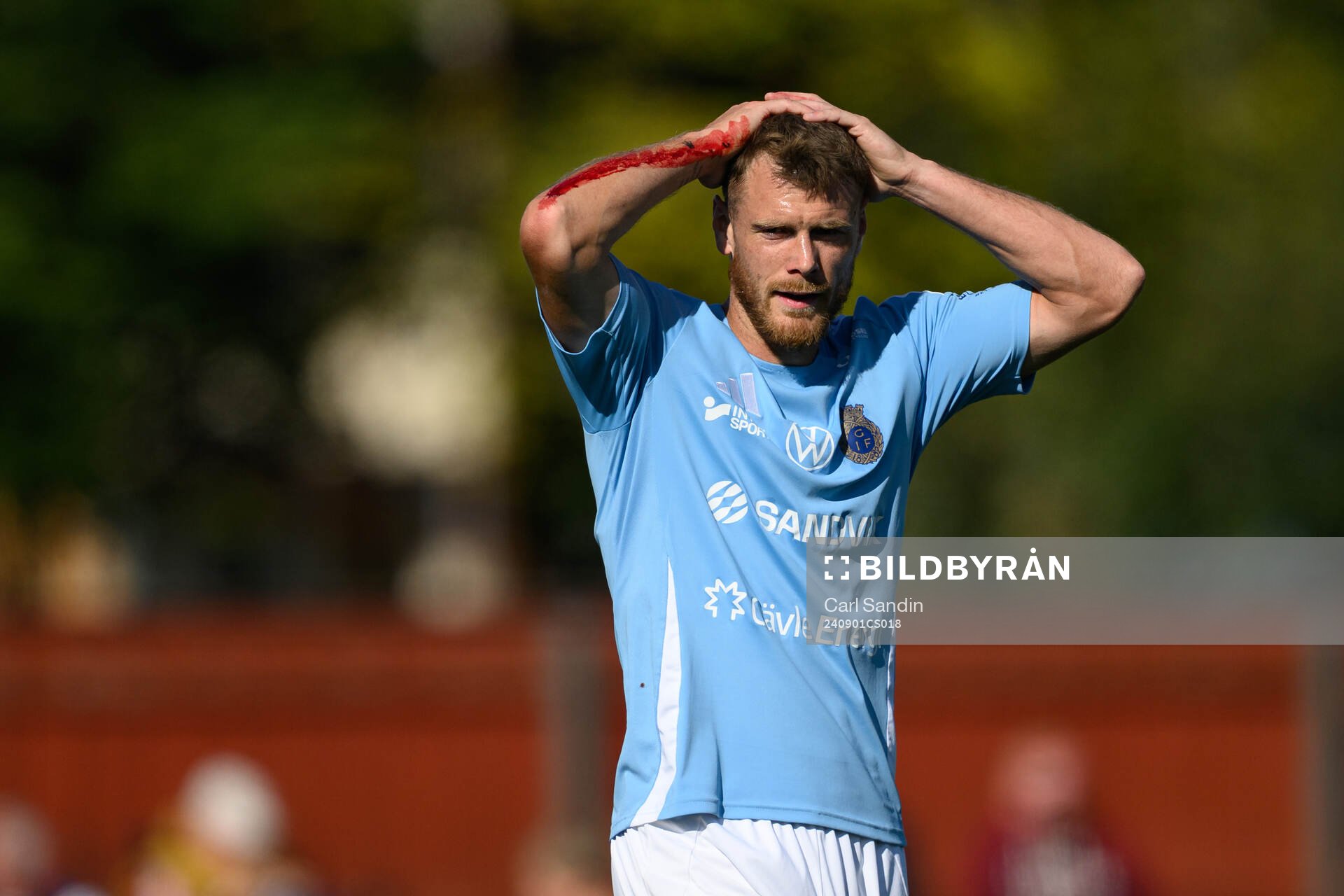 Gefles Leo Englund med blodig arm