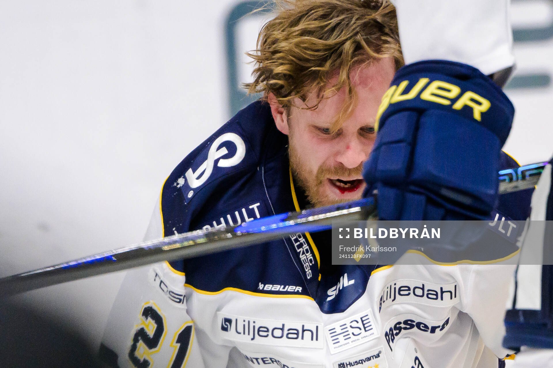 HV71s Mattias Tedenby har ont
