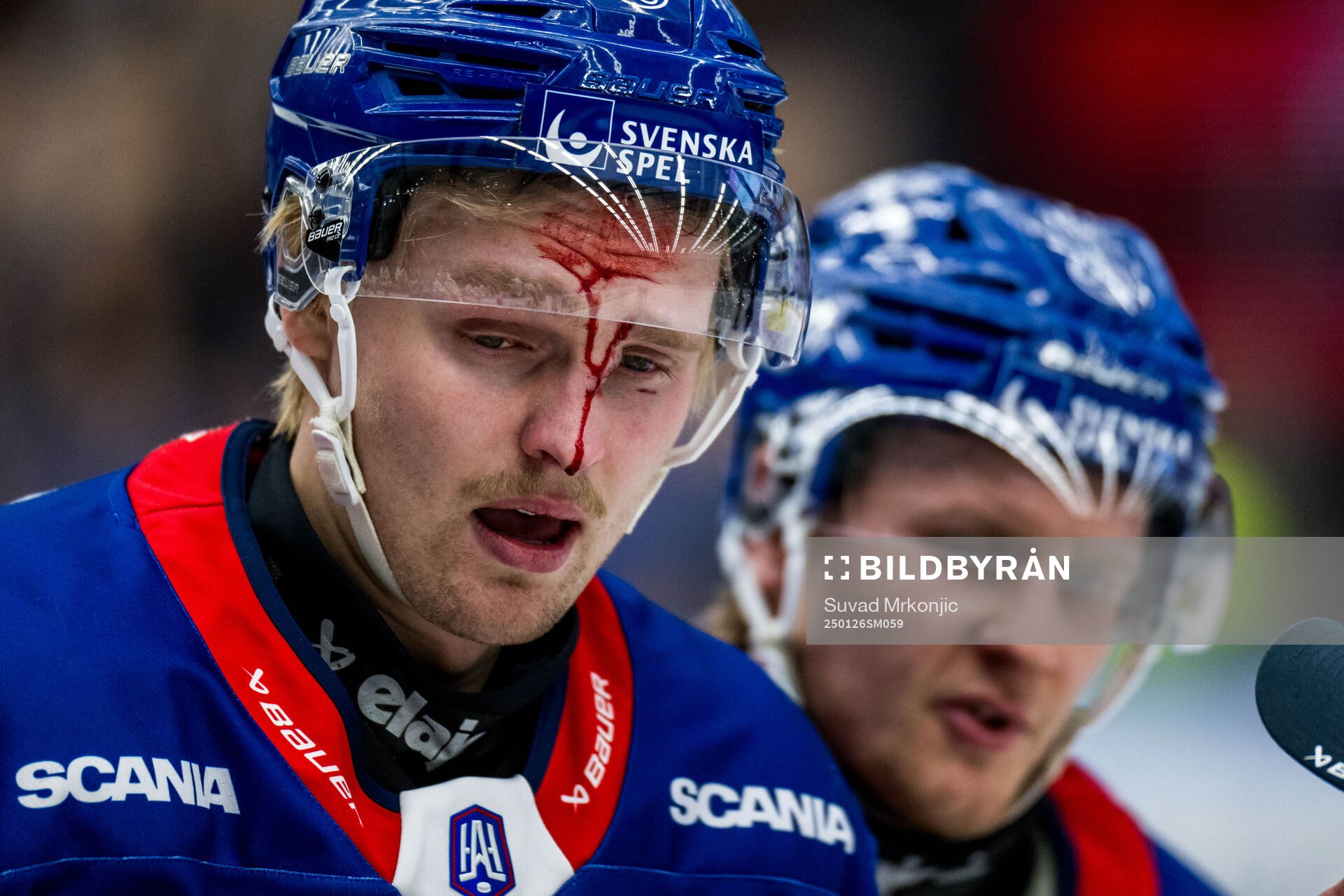 Oskarshamns Hampus Karlsson blöder