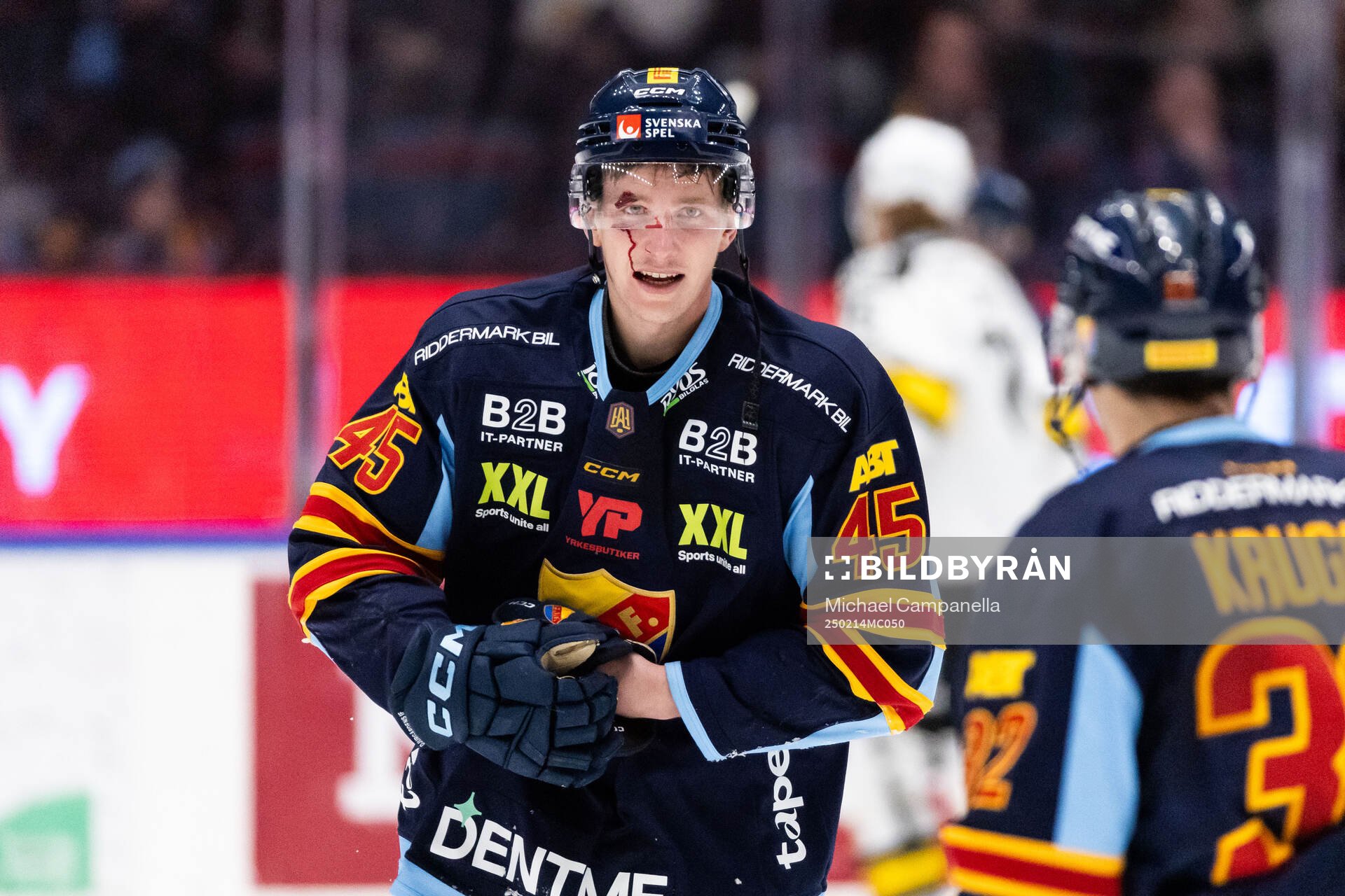 Djurgårdens Hugo Blixt har ont