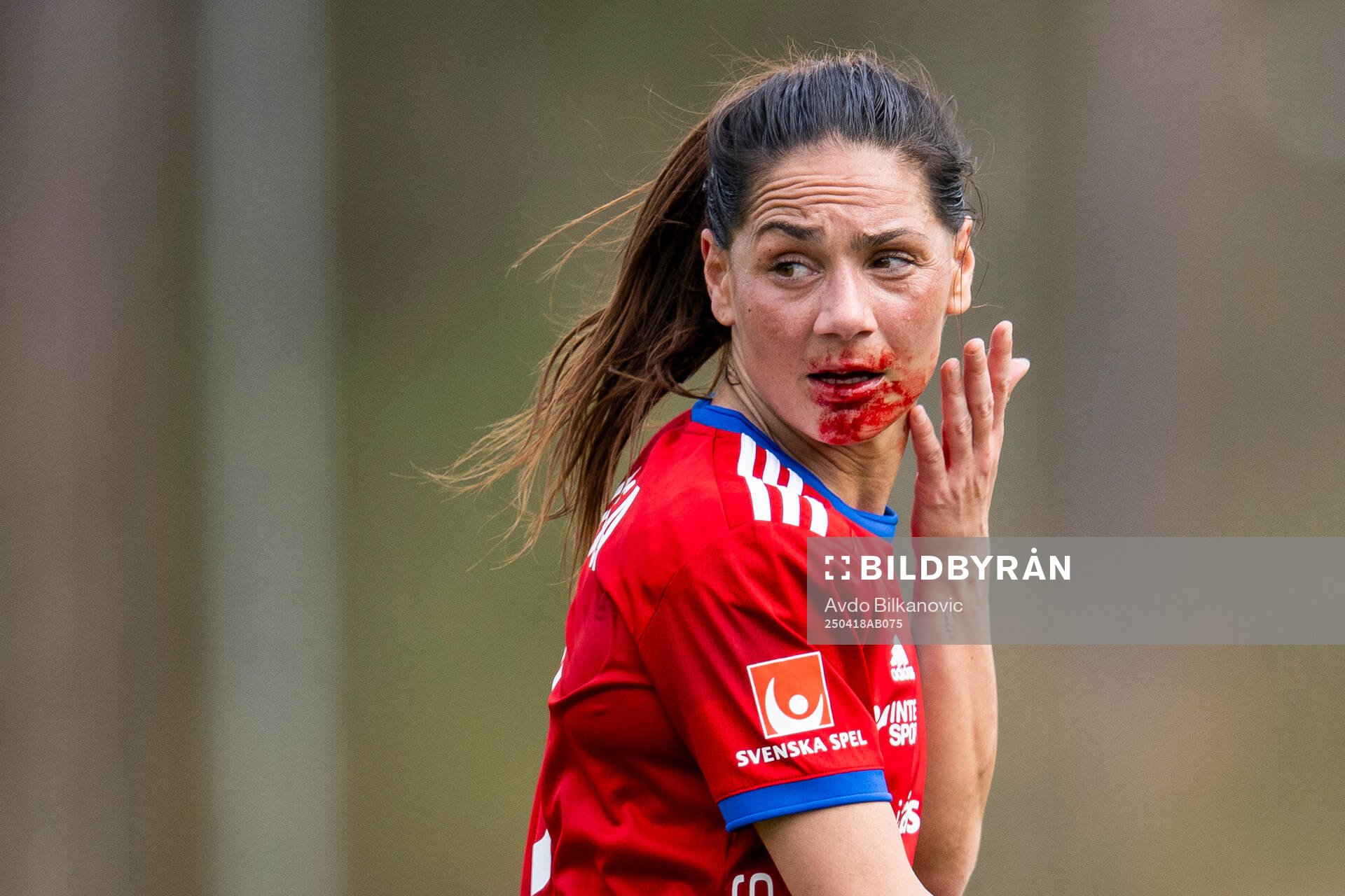 Vittsjös Elisabet Klinga med blod i ansikte
