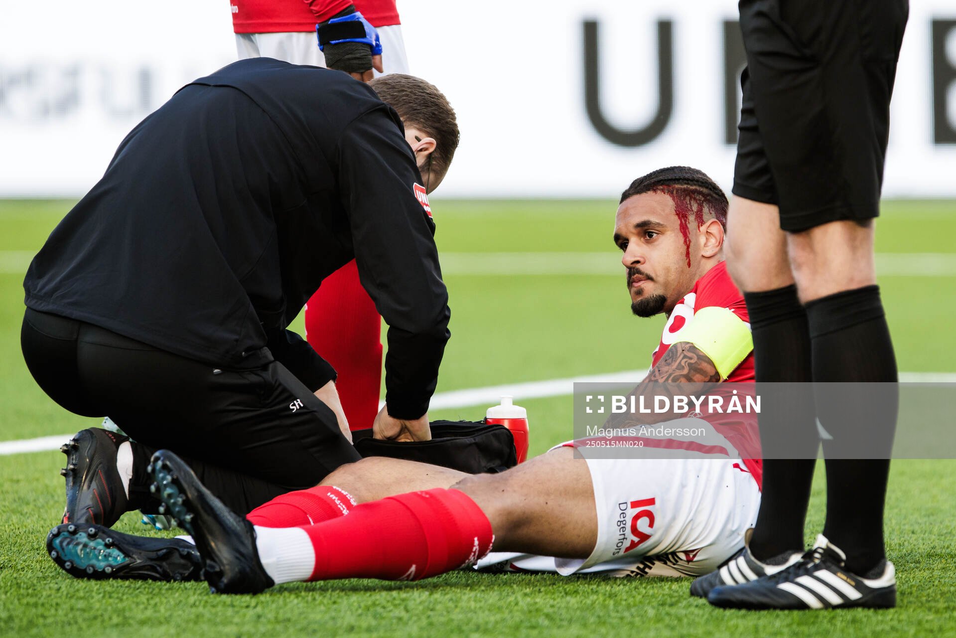 Degerfors Bernardo Gil Coutinho Morgado får vård under fotbollsmatchen i Allsvenskan mellan IFK Norrköping och Degerfors den 15 maj 2025 i Norrköping.