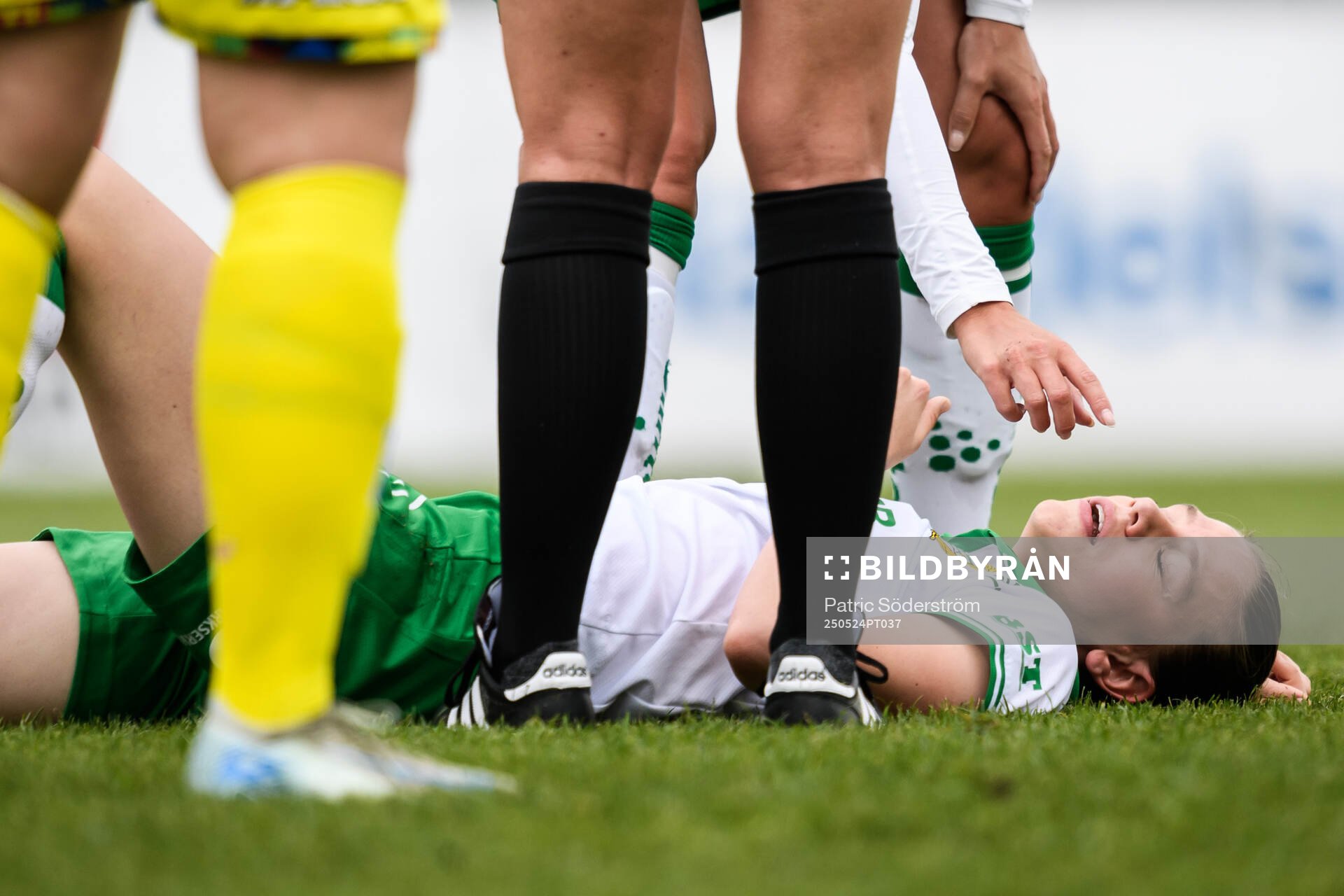 Hammarbys Bella Andersson har ont under fotbollsmatchen i Damallsvenskan mellan Kristianstad och Hammarby den 24 maj 2025 i Kristianstad.