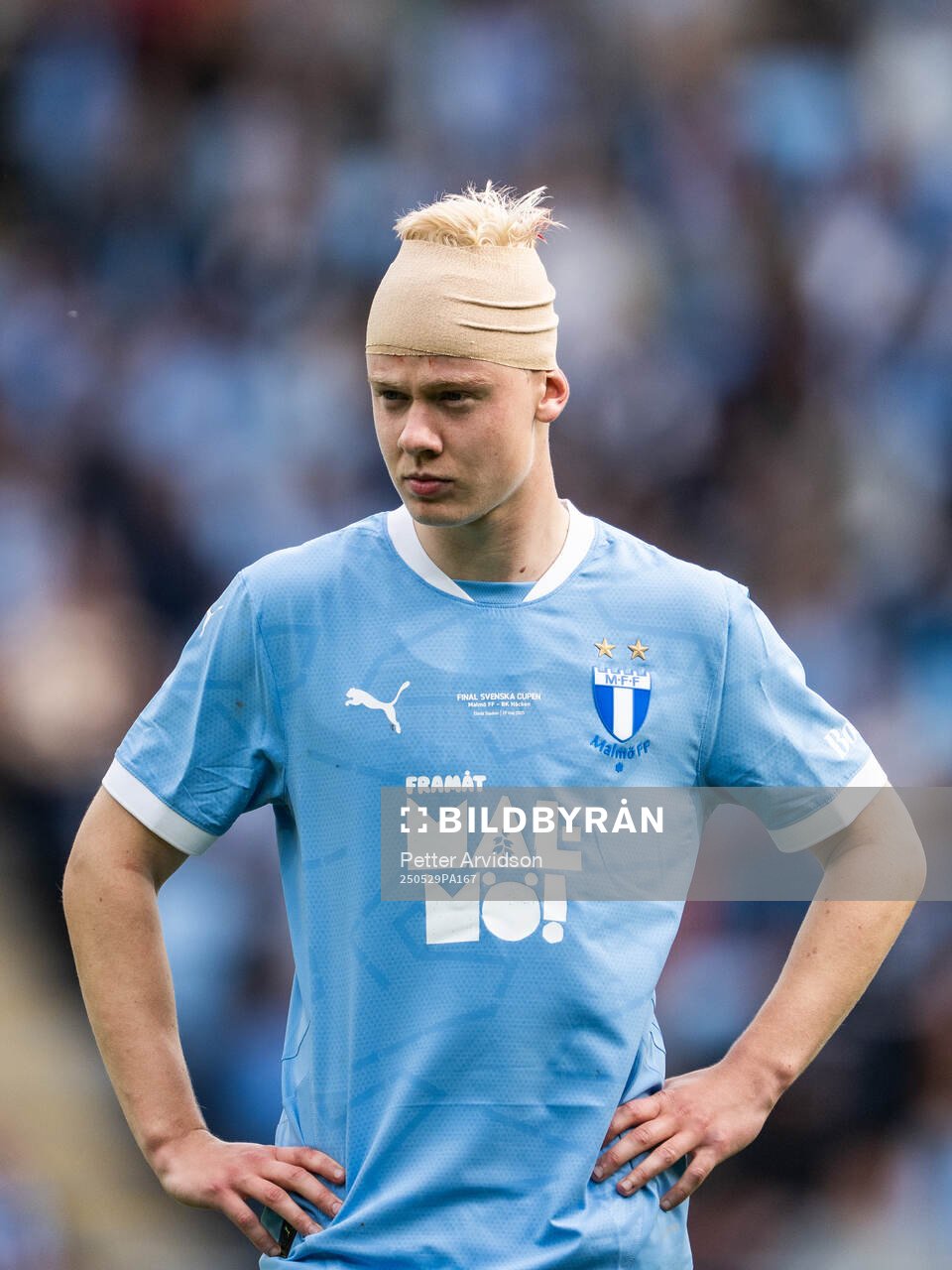 Malmö FFs Otto Rosengren med bandage runt huvudet under finalen i Svenska Cupen mellan Malmö FF och Häcken den 29 maj 2025 i Malmö.