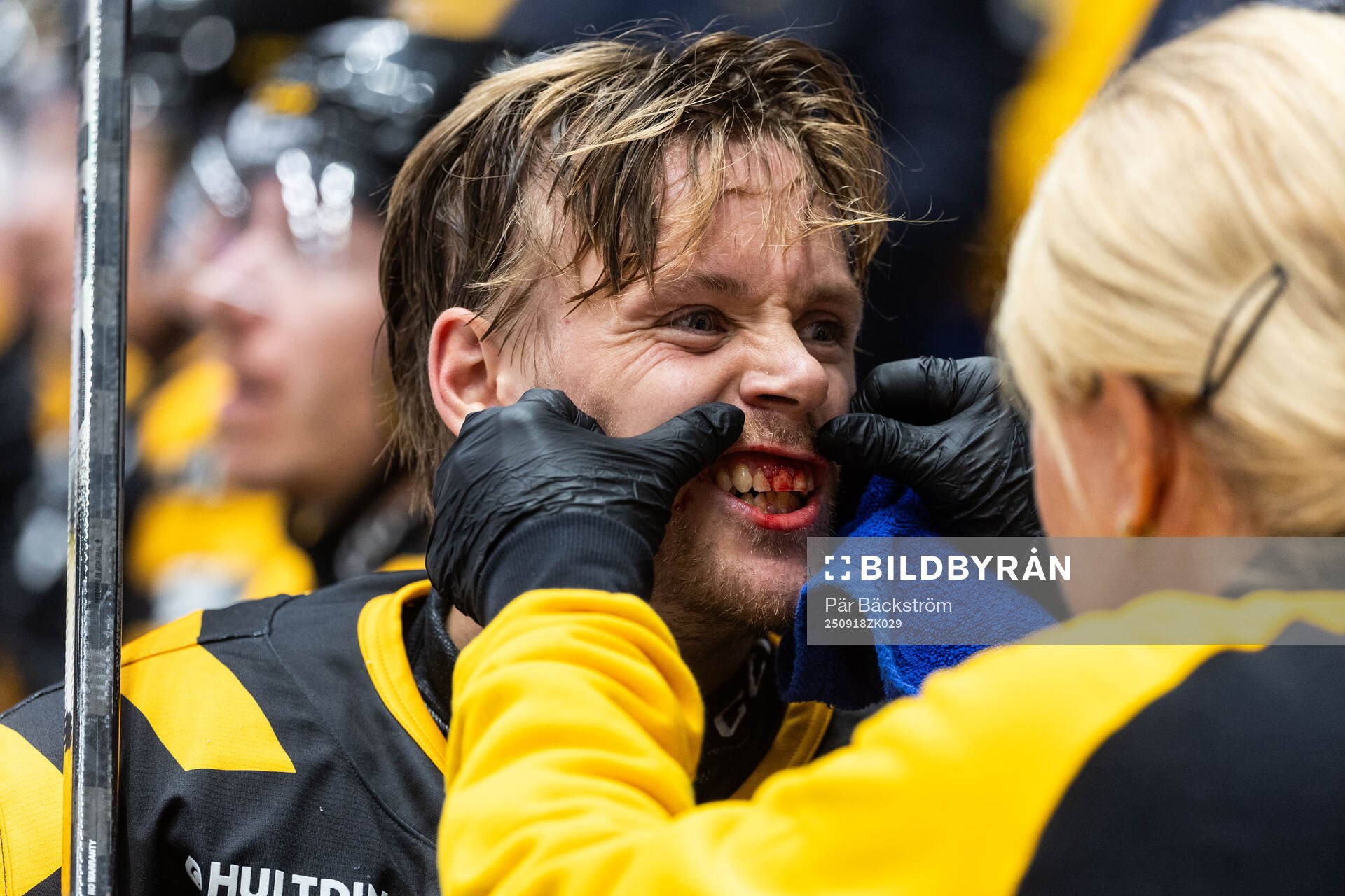 Skellefteås Mikkel Aagaard får vård