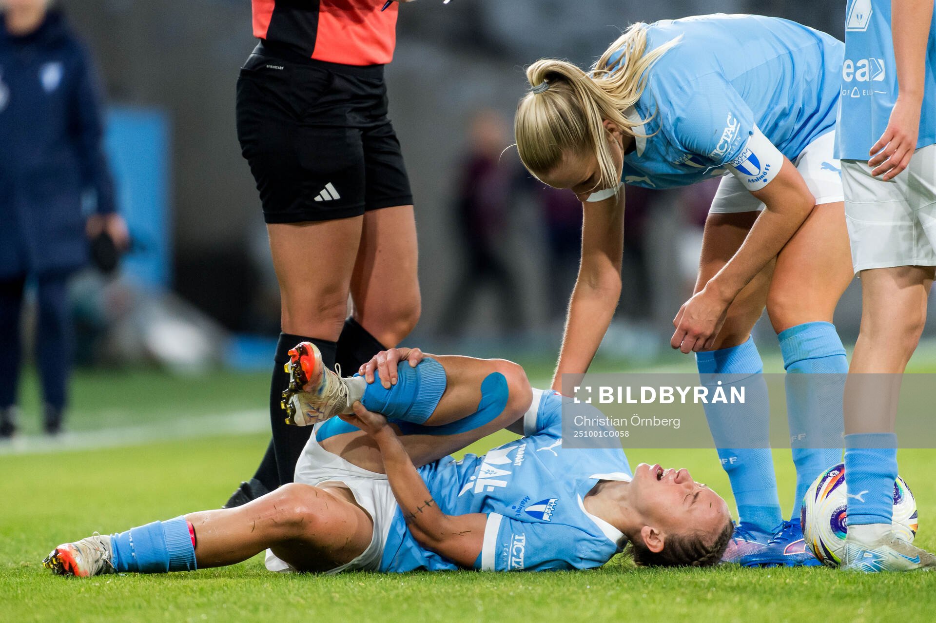 Malmö FFs Miljana Ivanovic har ont
