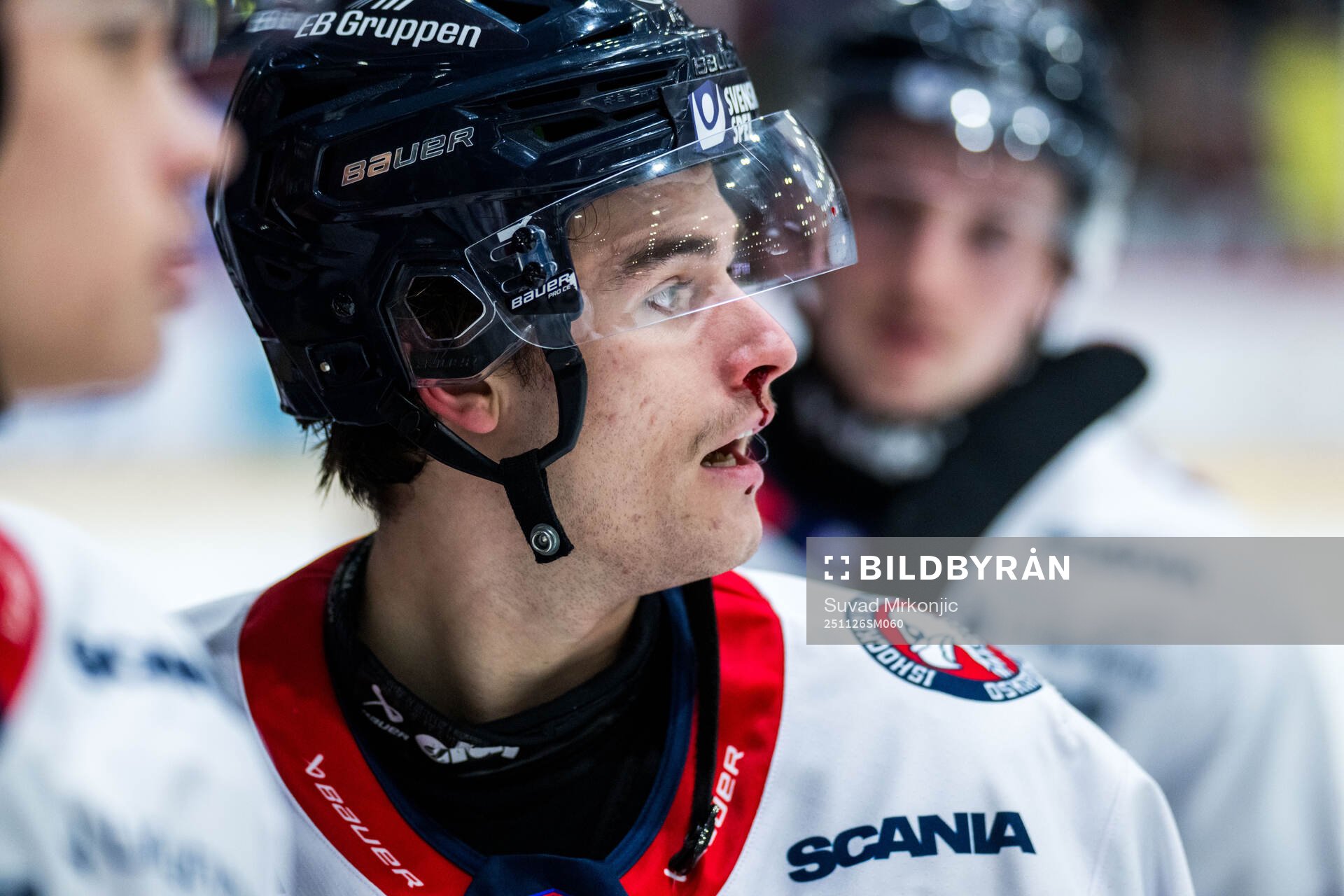 Oskarshamns Ville Jonsson blöder