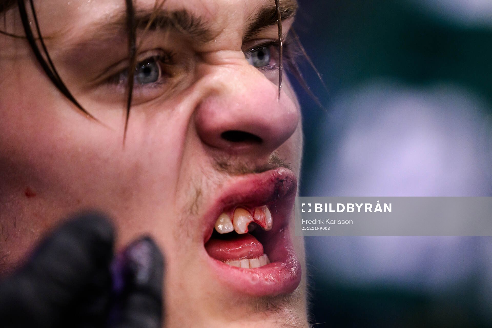 This picture is part of Bildbyrån’s selection of best
