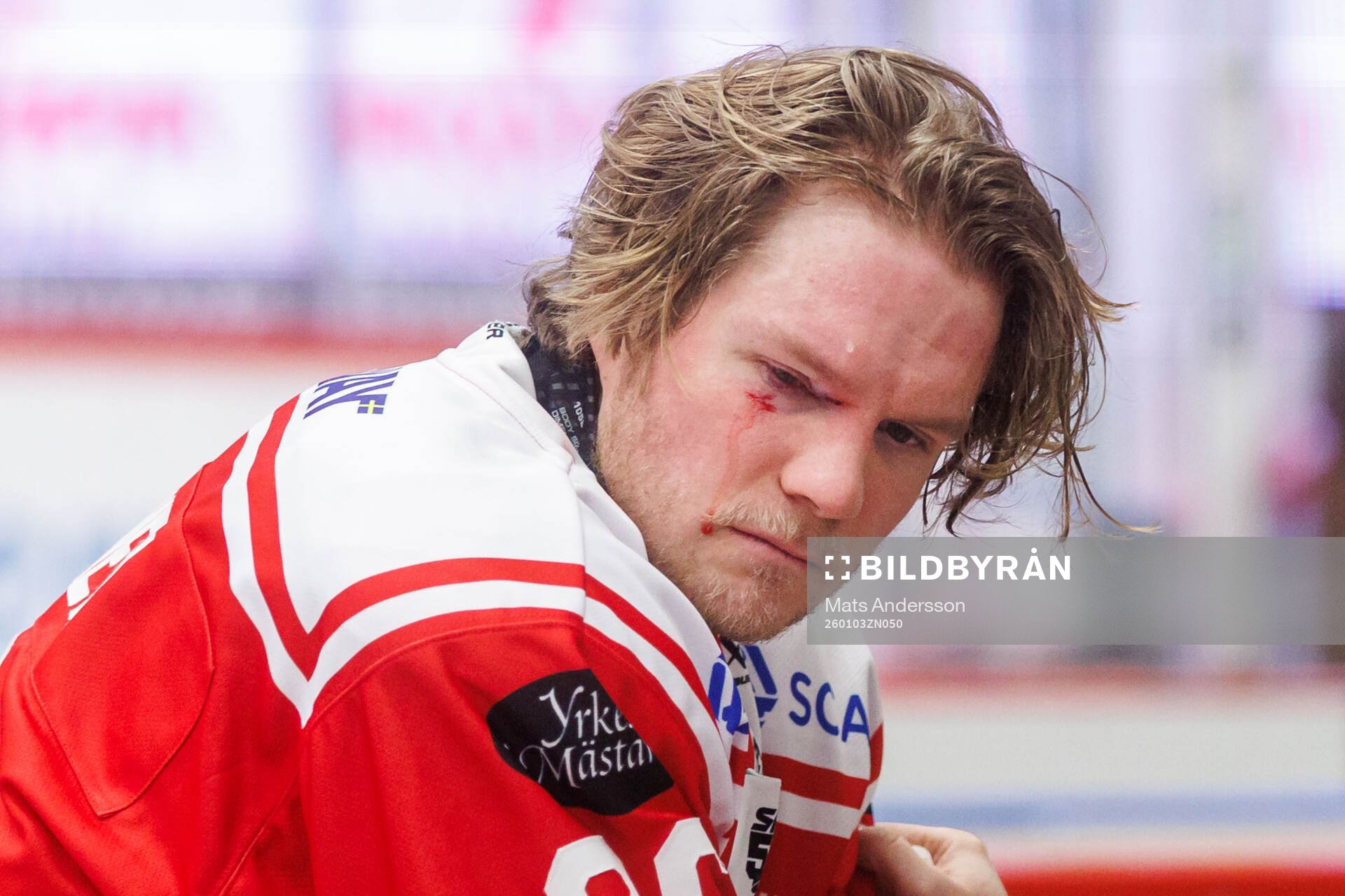 Timrås Anton Heikkinen får vård