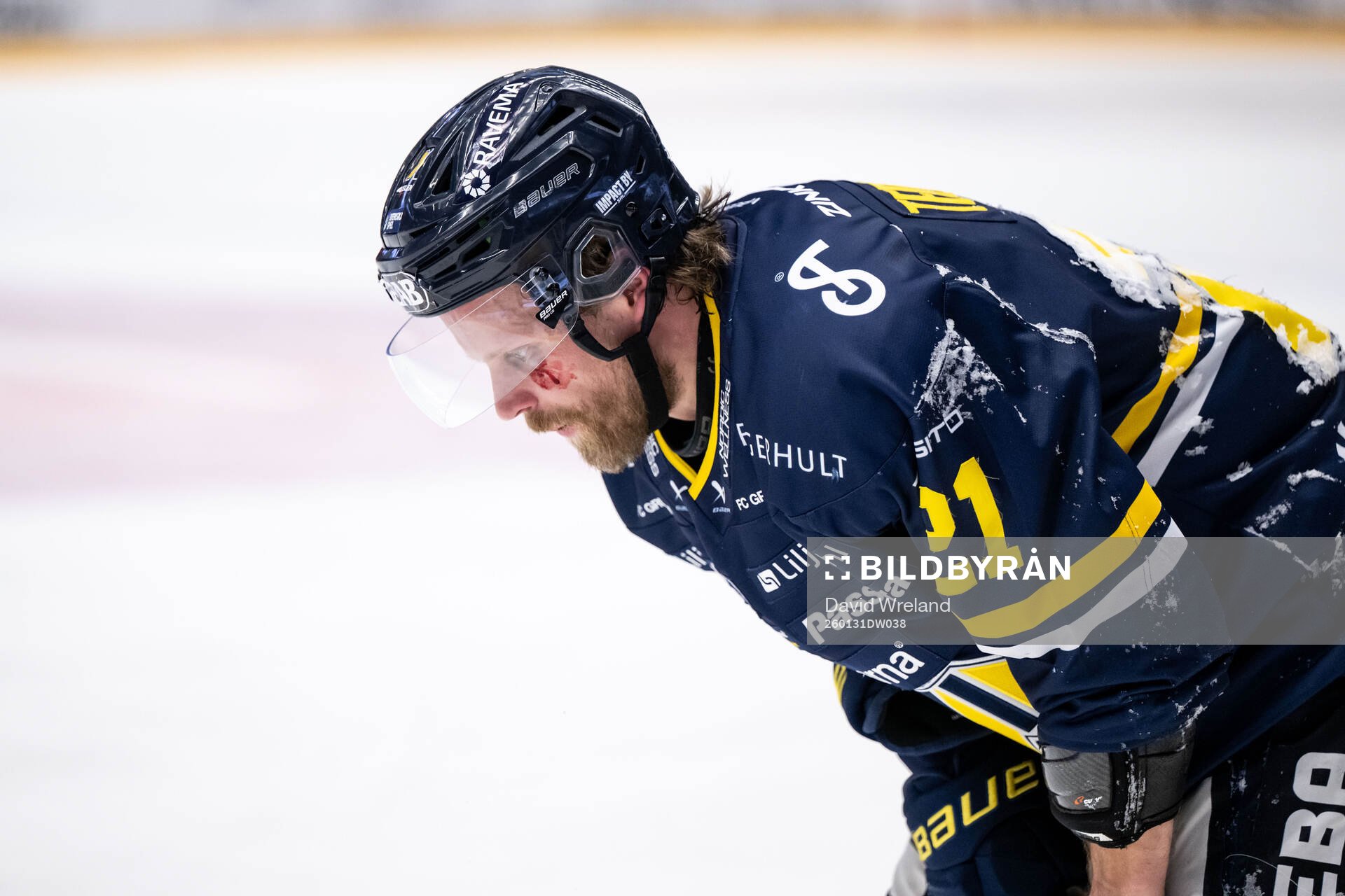 HV71s Mattias Tedenby har ont