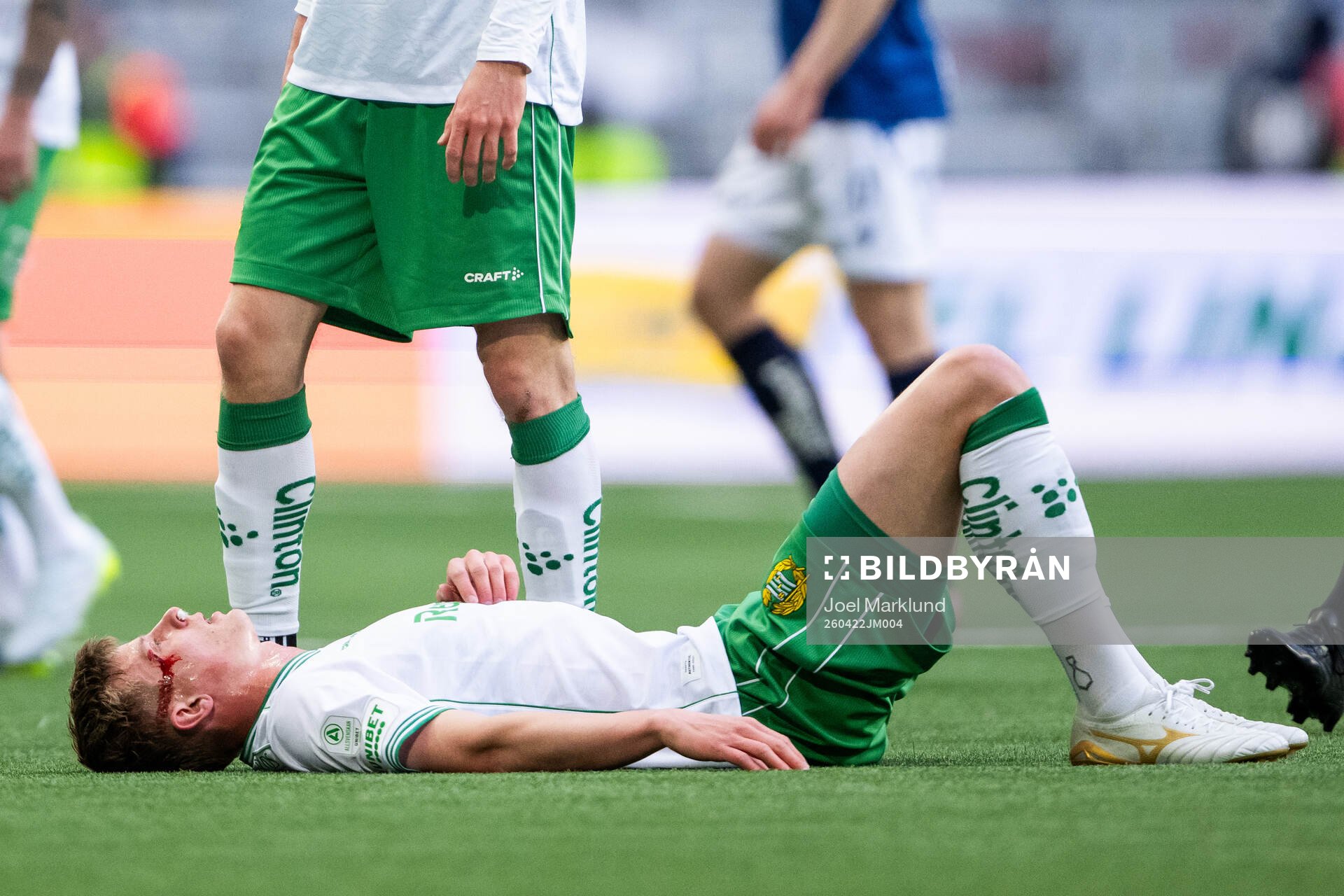 Hammarbys Frederik Winther blöder från ögonbrynet