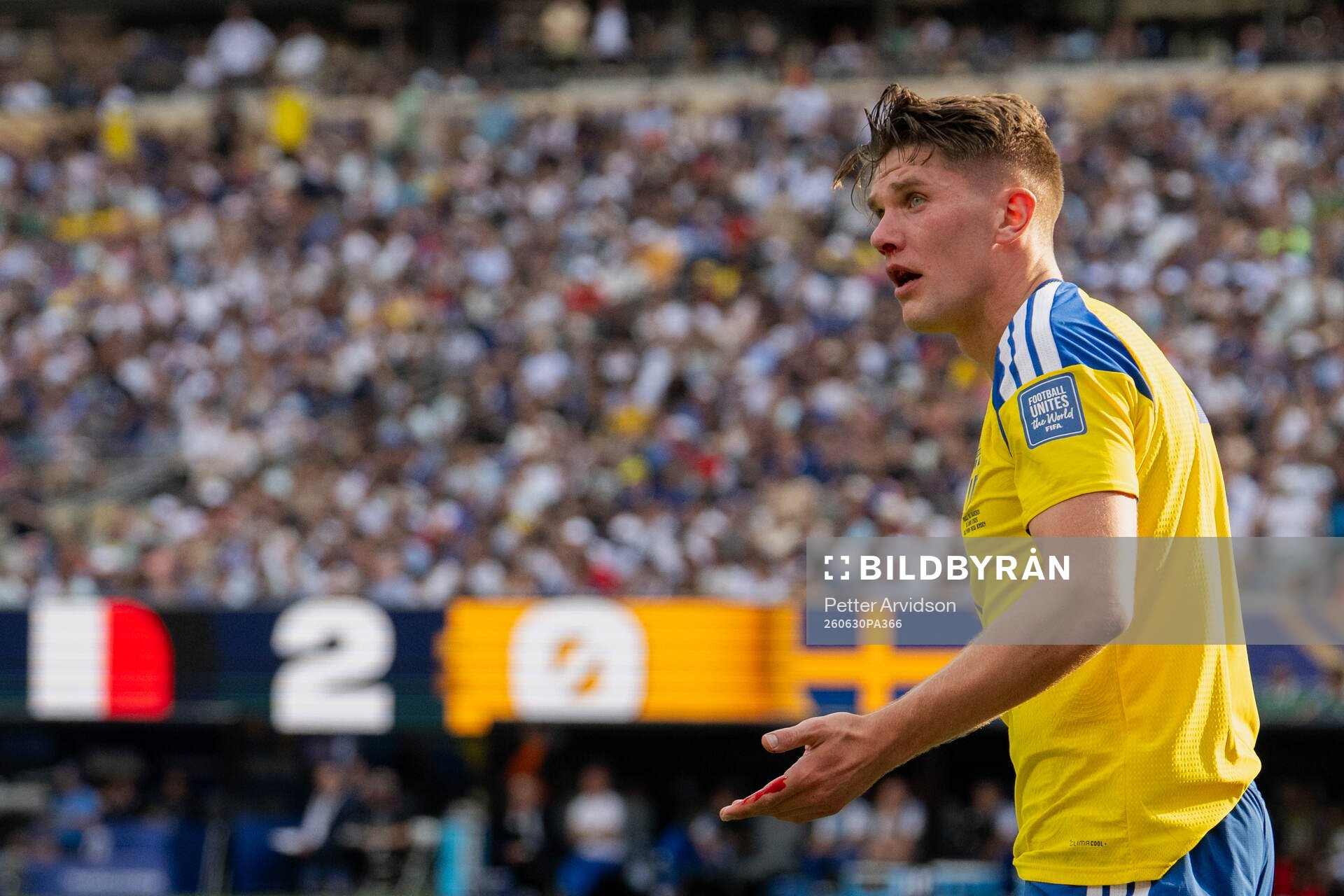 Viktor Gyökeres of Sweden is seen bleeding