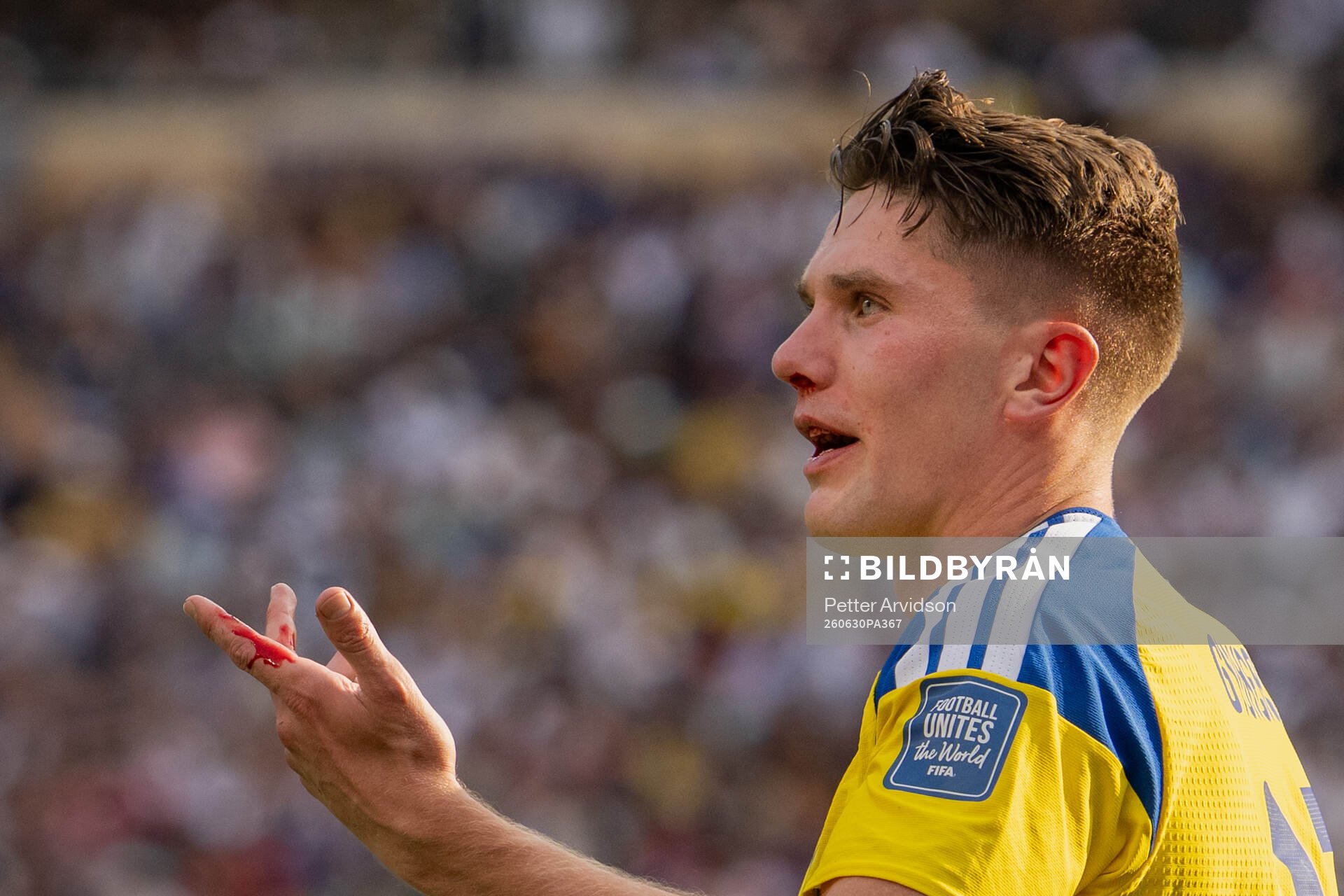 Viktor Gyökeres of Sweden is seen bleeding