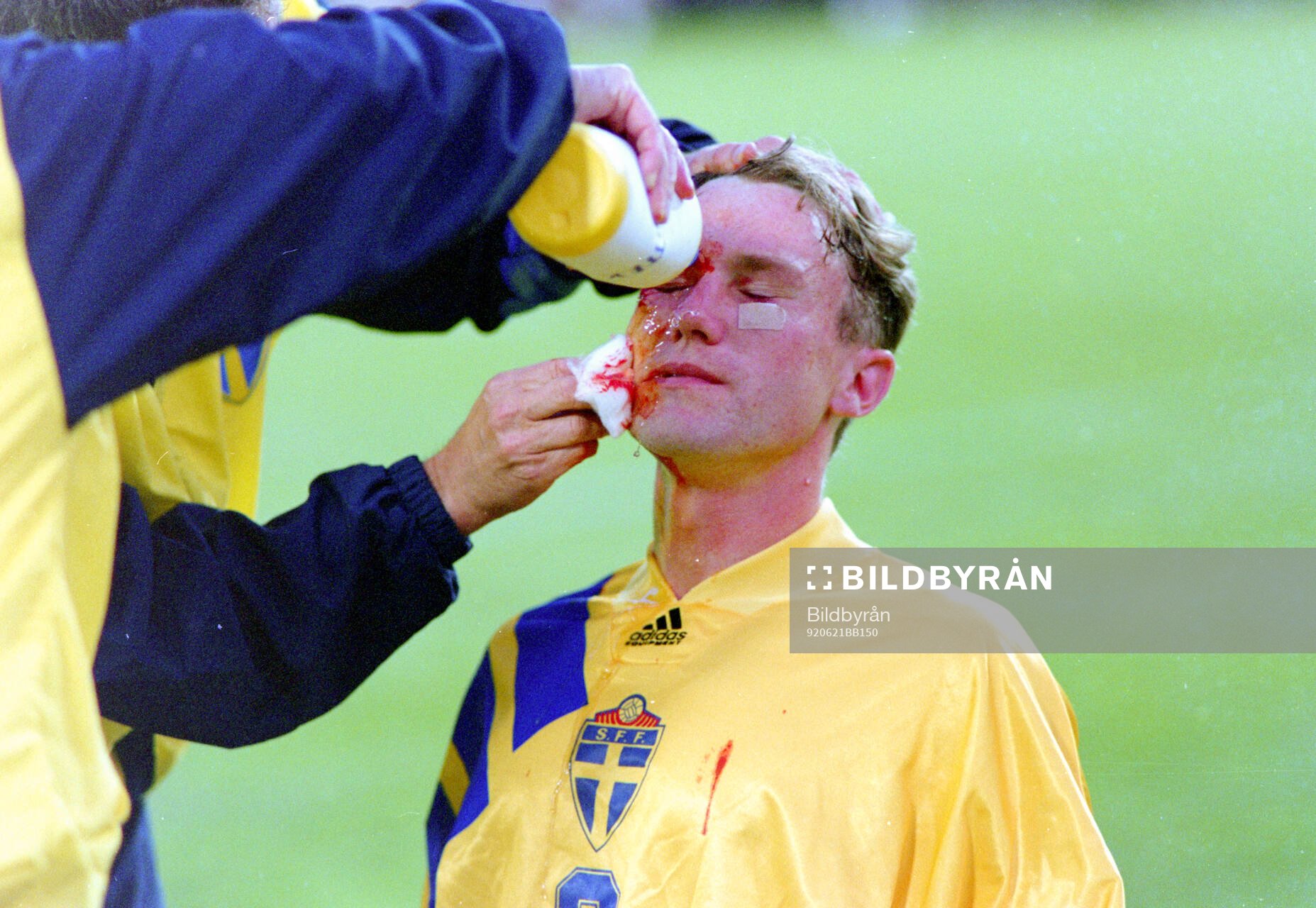 Jan Eriksson of Sweden gets medical attention