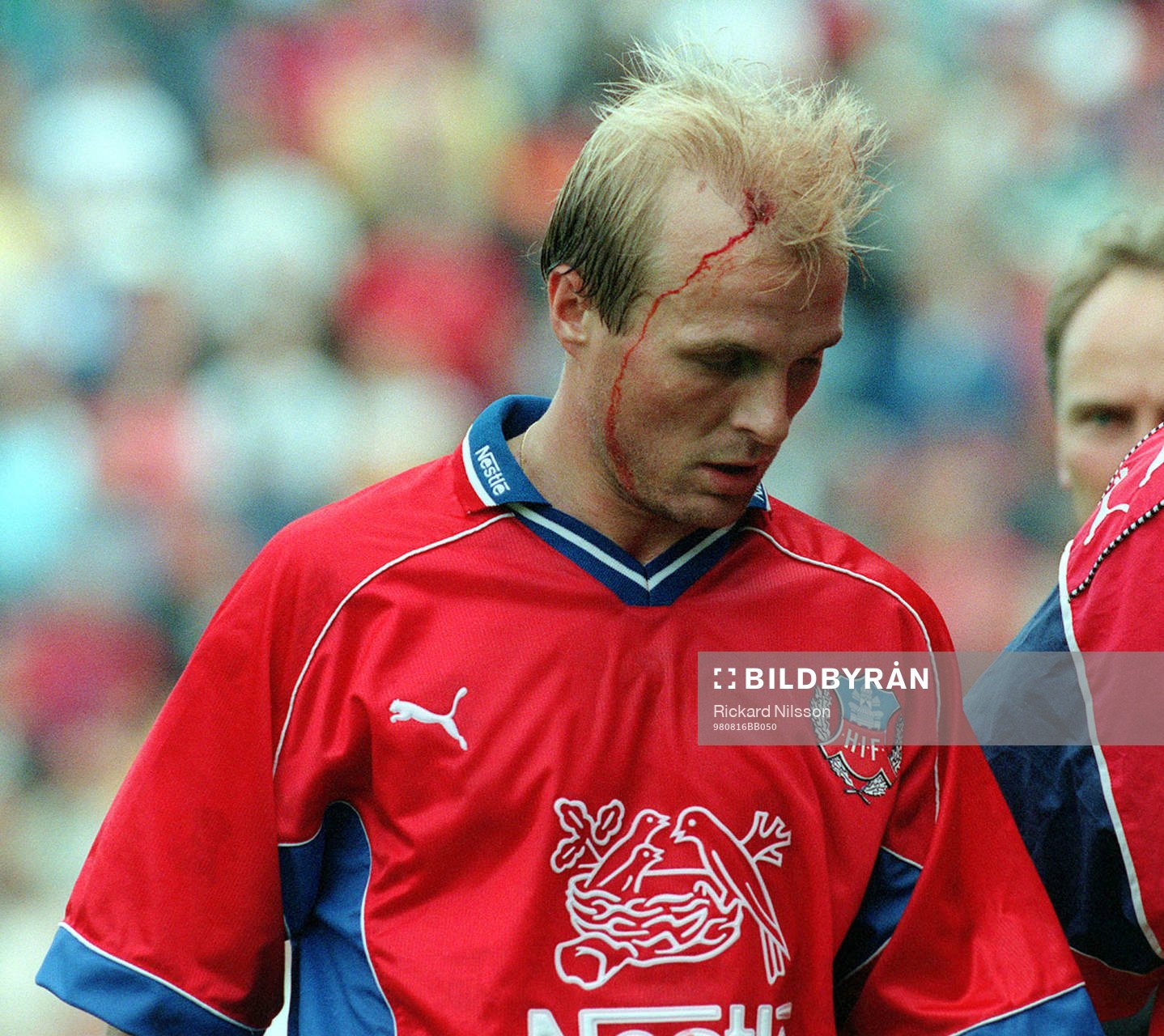 Peter Wibrån, Helsingborg kar skadat sig i pannan