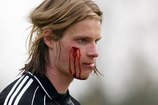 Fredrik Andersson (Fredrik Hana Andersson), IFK Hässleholm