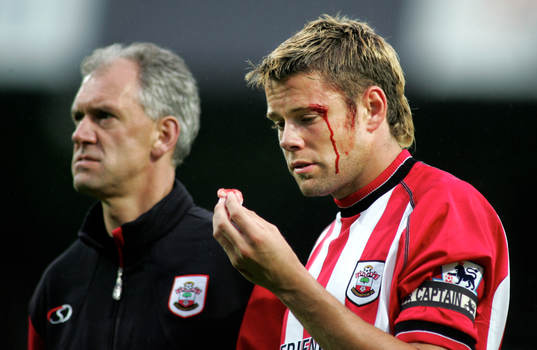  James Beattie, Southampton. Skada, blod.