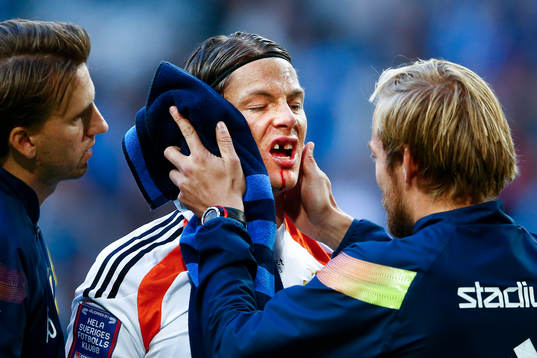 Djurgårdens målvakt Kenneth Høie väljer att fortsätta spela trots att han tappat en tand efter krock med Malmö FFs Markus Rosenberg