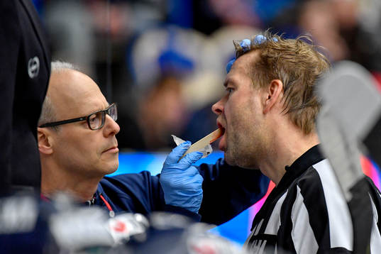 Domare Patrik Sjöberg träffas av en klubba över munnen