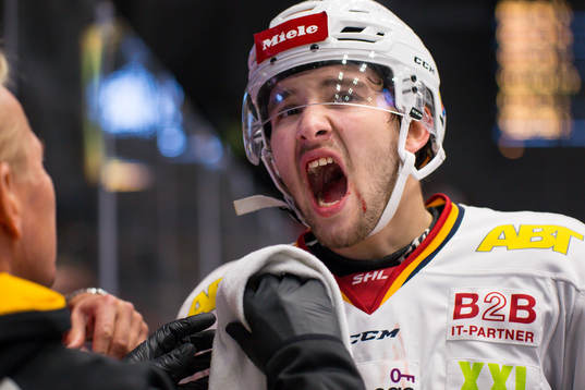 Djurgårdens Emil Bemström fick en klubba i munnen
