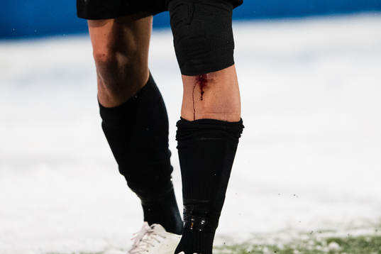 Ett sår blöder på en spelare