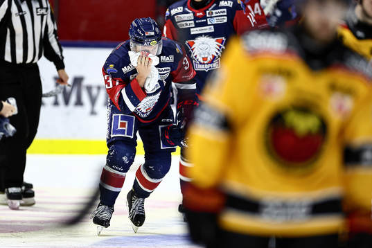 Linköpings Jesper Pettersson har fått en puck i ansiktet