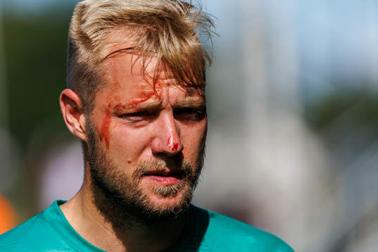 Jönköpings Sebastian Crona med blod i ansiktet