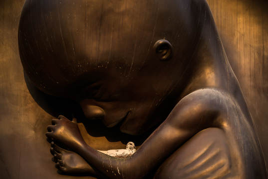 En duva ruvar över sitt bo på konstverket The Miraculous Journey av Damien Hirst utanför sjukhuset Sida Medicine