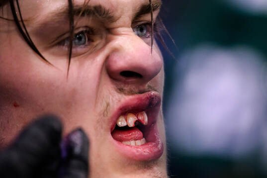 This picture is part of Bildbyrån’s selection of best